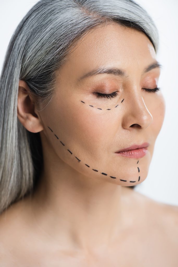 lifting facial